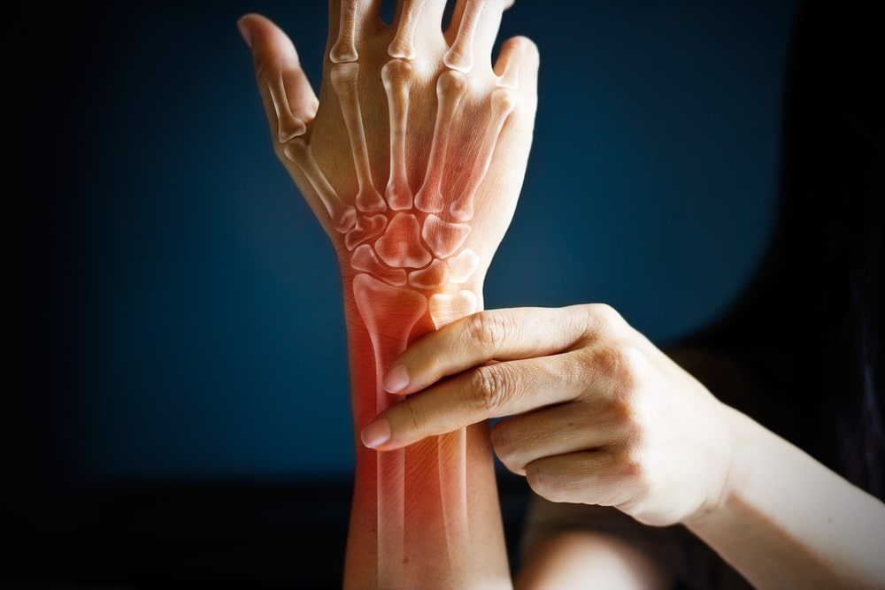 Consultation arthrose personnalisée !