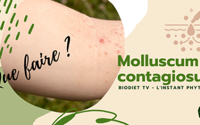 Molluscum contagiosum, que faire ?