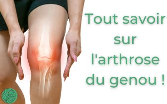 Arthrose du genou, c’est quoi ?