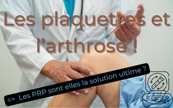 PRP : Une Révolution dans la Gestion de l’Arthrose.