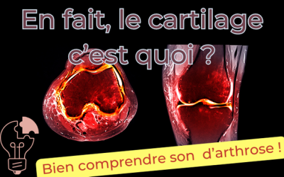Arthrose, le cartilage c’est quoi ?