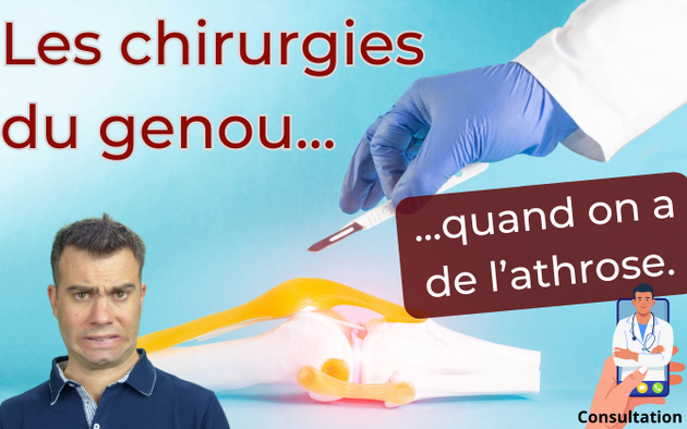Quelles sont les différents chirurgies quand on a de l’arthrose.