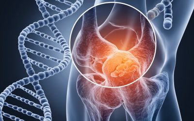 Arthrose et épigénétique