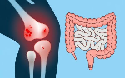 Arthrose et inflammation de bas grade.